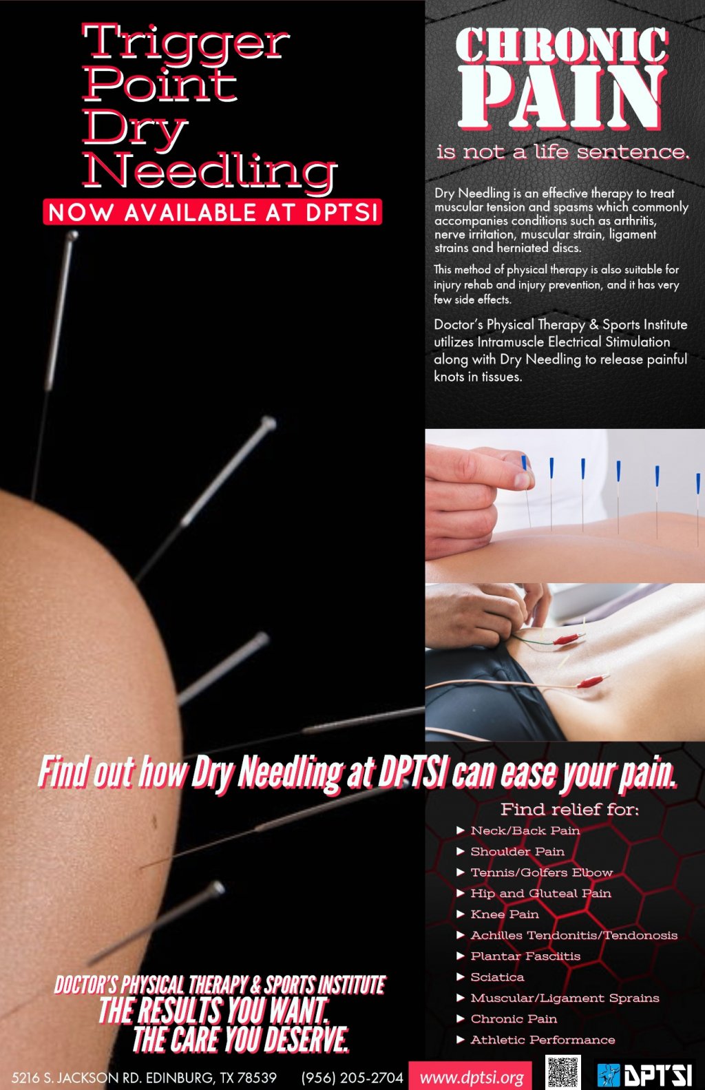 image-739915-Dry_Needling_Poster.w640.jpg