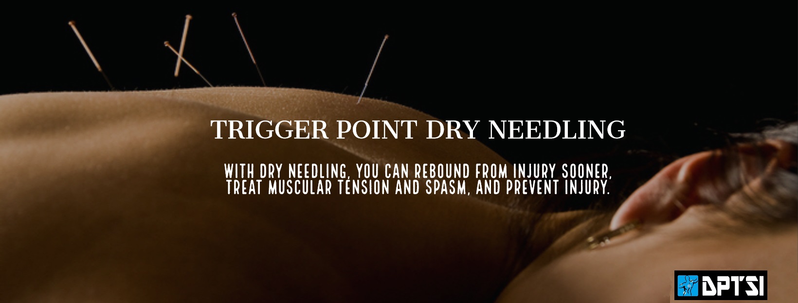 image-751998-Dry_Needling_Cover_Photo2.jpg